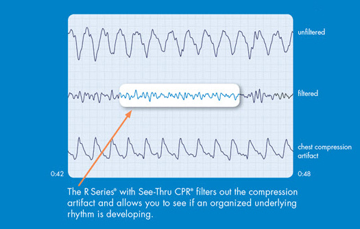 See-thru CPR waveform Hi Res