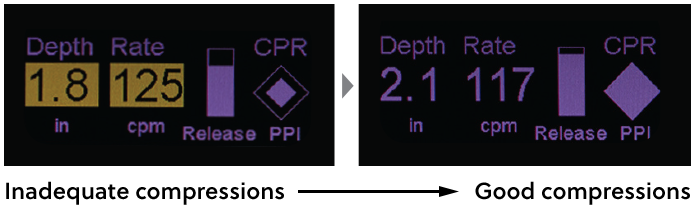 CPR Feedback